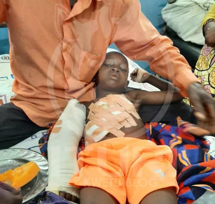 Ituri: Salomon, 4 ans d’âge, échappe « miraculeusement » à la mort par machette de miliciens. (Il a besoin d’aide)