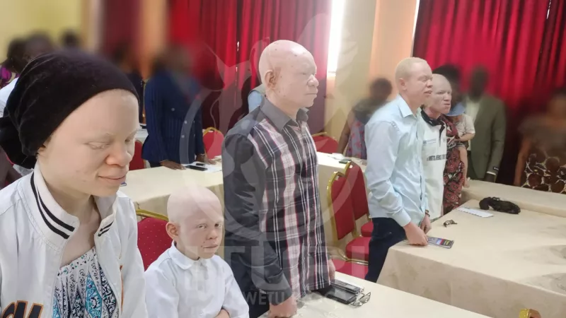 Des témoignages émouvants des personnes atteintes d’albinisme, objets d’affliction de tout genre en Ituri