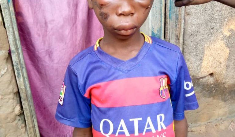 Mongbwalu, une fillette perd 5 000 Fc de sa marâtre, et subit la torture jusqu’à l’agonie