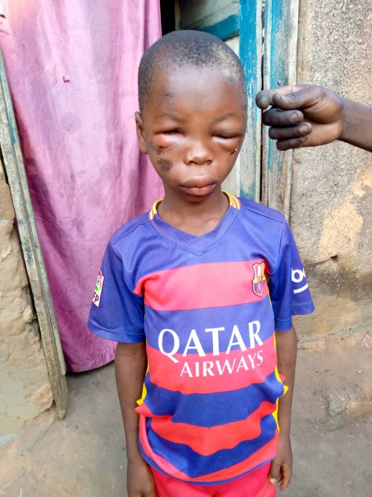 Mongbwalu, une fillette perd 5 000 Fc de sa marâtre, et subit la torture jusqu’à l’agonie